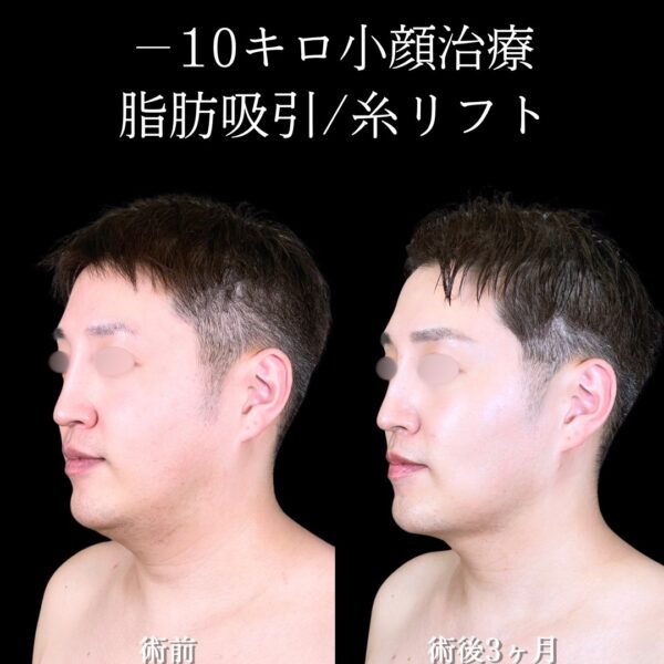 No.16546の症例写真